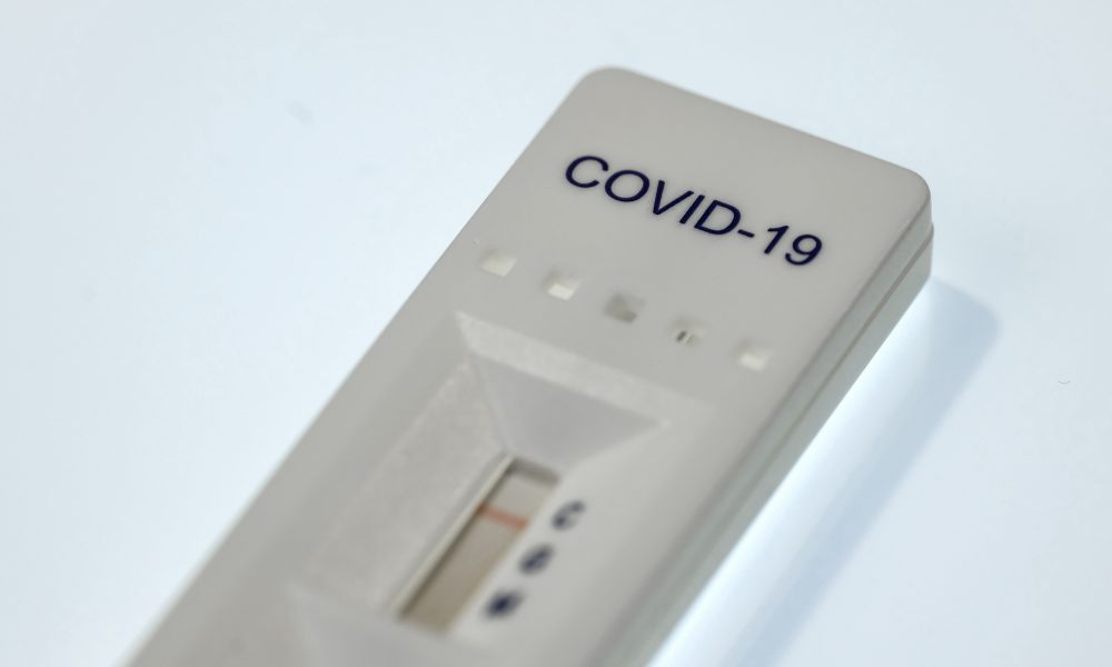 Covid-19 test for detecting IgM IgG antibodies and immunity in minutes